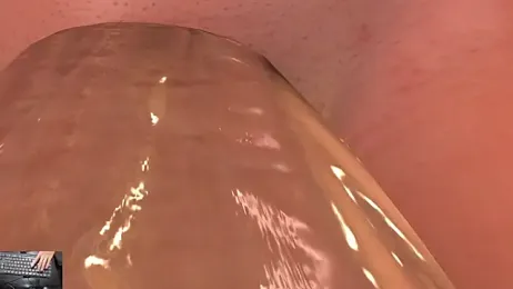 pretty_eymi webcam stripchat model stream image